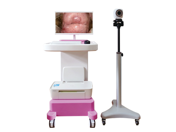 电子阴道镜高清像素检测妇科宫颈诊断仪器